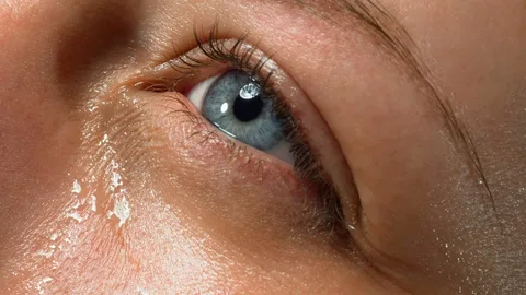 Home Remedies for Watery Eyes